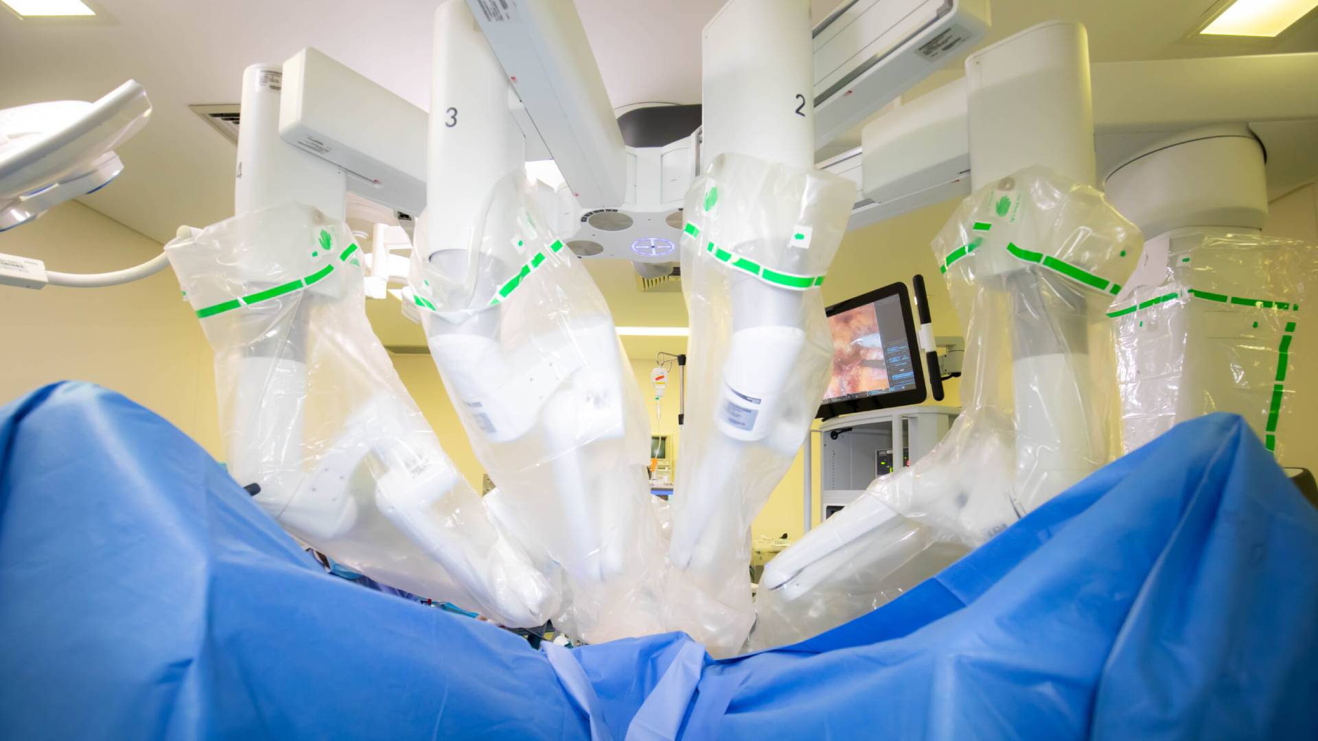 El-Hospital-Vithas-Malaga-incorpora-el-robot-Da-Vinci-para-operar-con-mayor-precision-y-menos-riesgo